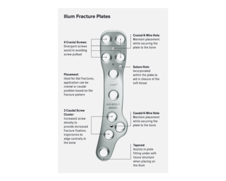 Ilium Fracture Plates Anatomic Design